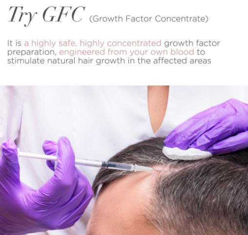 PRP for Hair loss Procedure